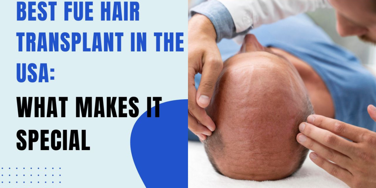 Best FUE Hair Transplant in the USA: What Makes It Special